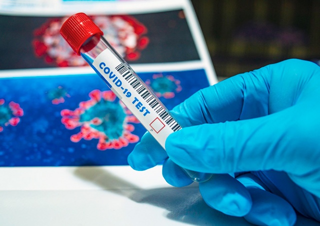В Чехии началась запись на бесплатное массовое тестирование на коронавирус