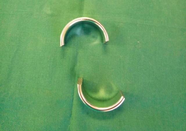 В Чехии пожарным пришлось срезать кольцо с пениса пациента
