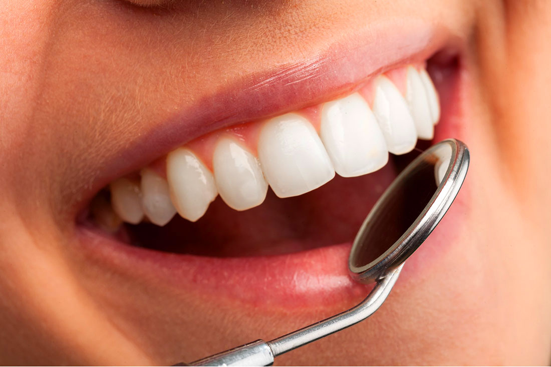 15 неожиданных фактов о зубах, которые вы не знали